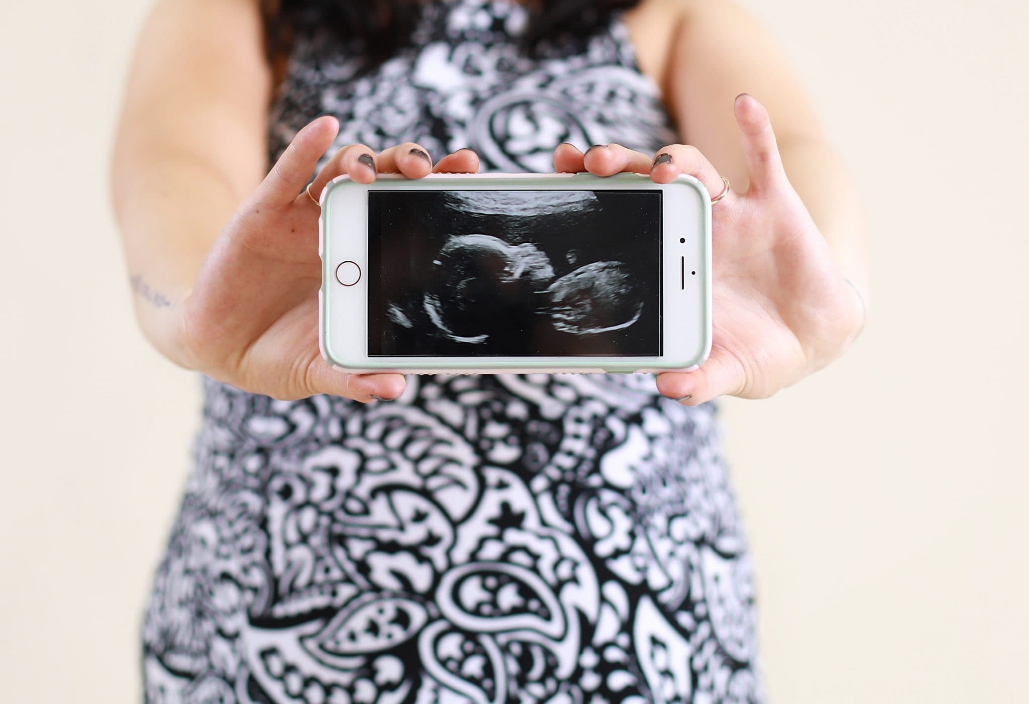 new mom, pattern dress, hands holding phone with ultrasound picture
